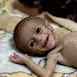 FEED GAZA